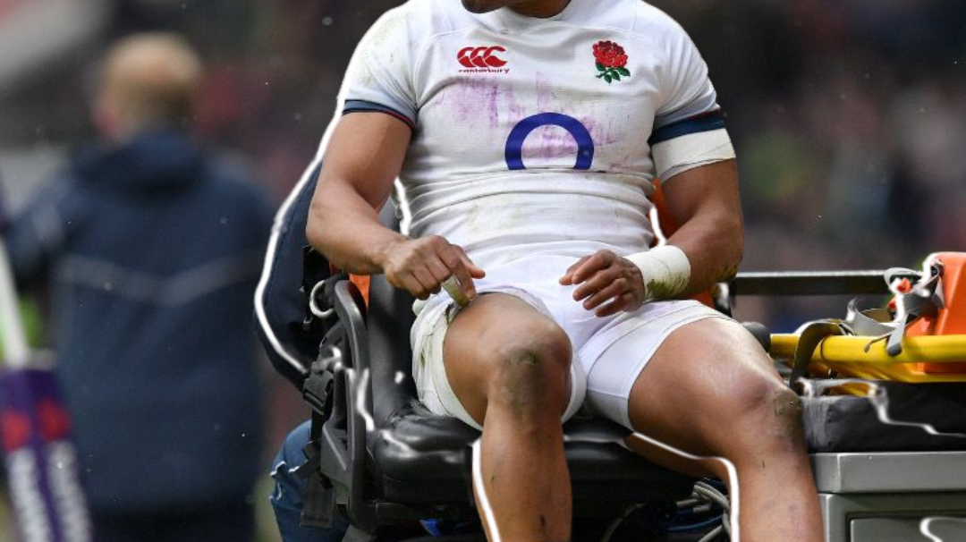 Top Tips to Prevent Rugby Injuries: A Comprehensive Guide